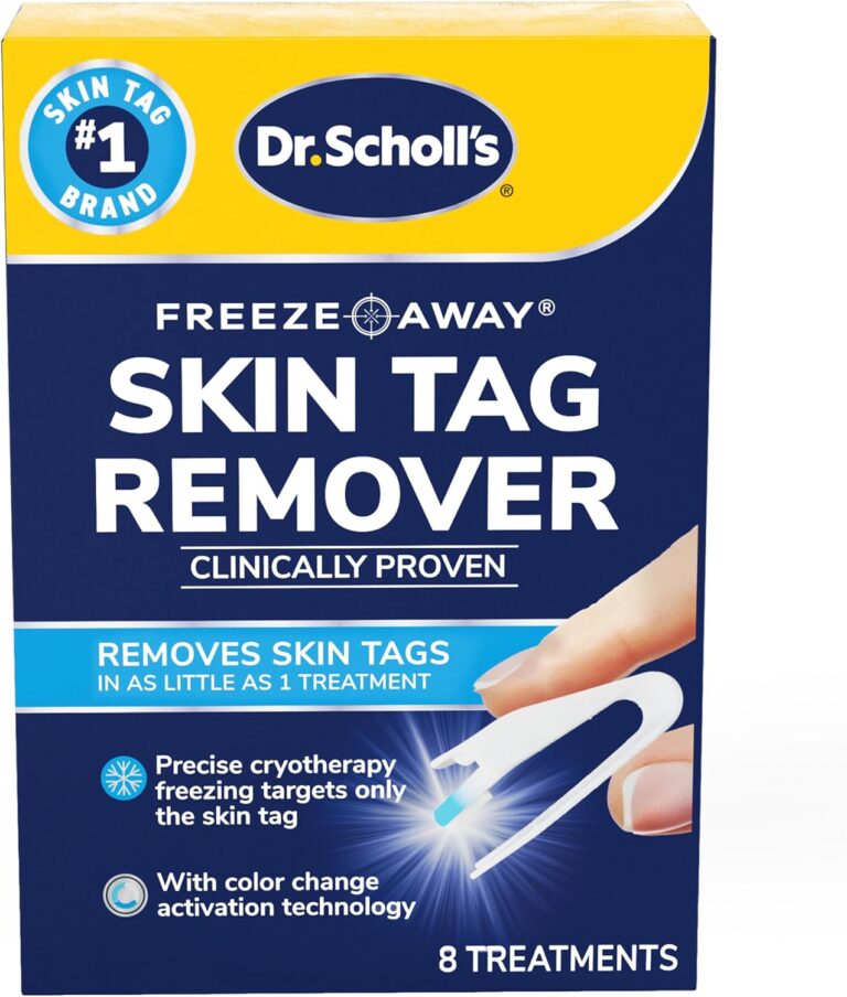 skin tag