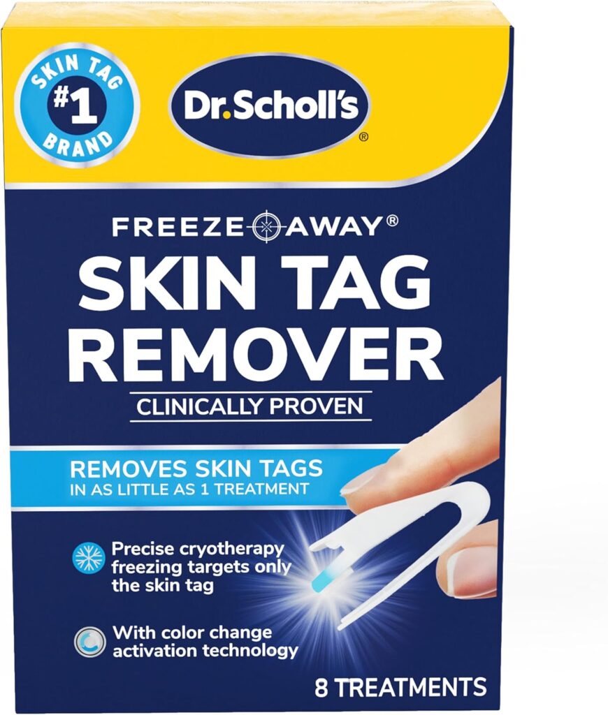 skin tag