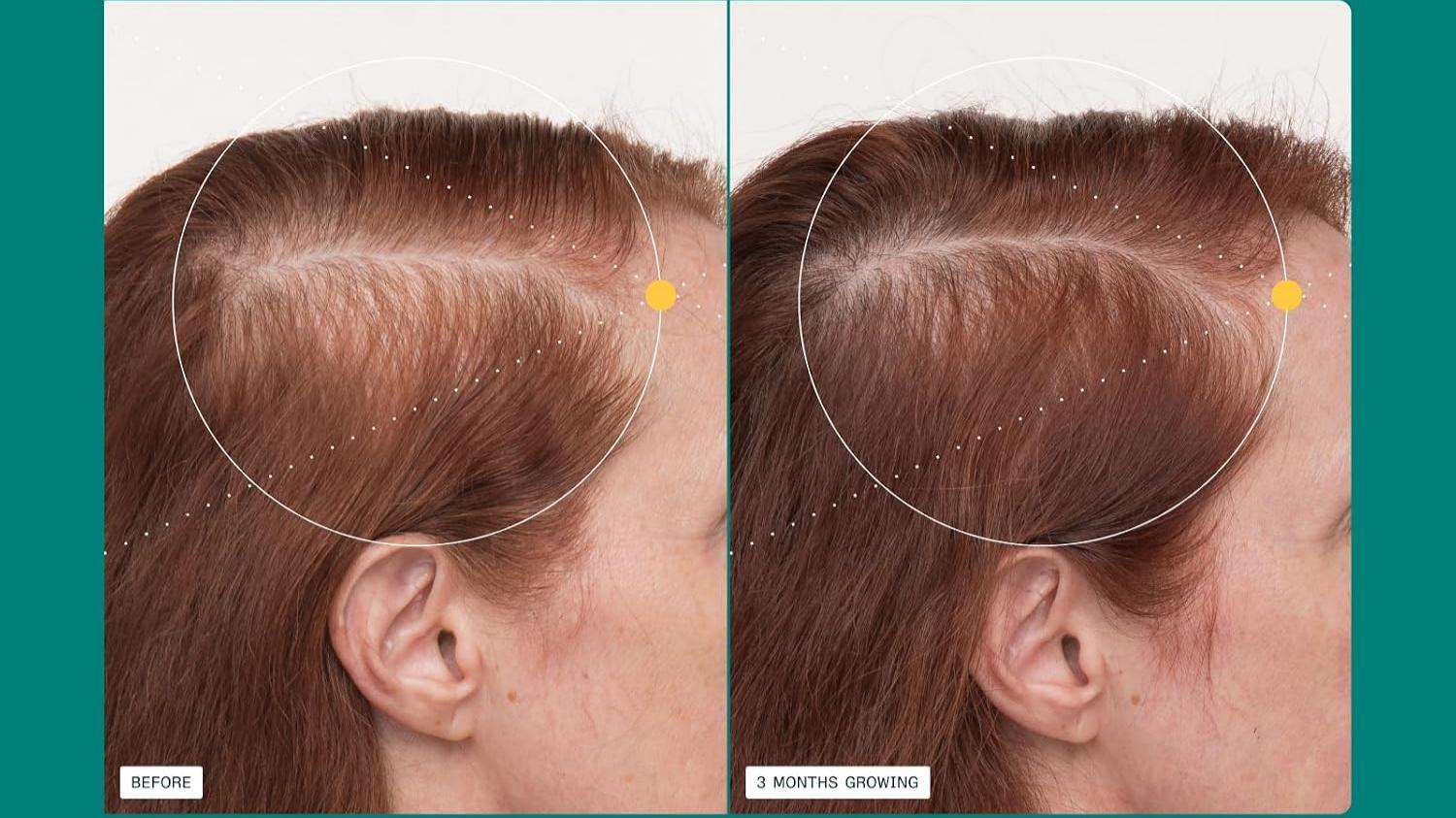 hair serum